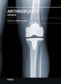 Arthroplasty - Update