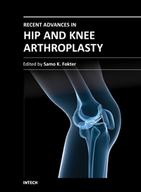 Recent Advances in Arthroplasty